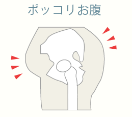 ポッコリお腹